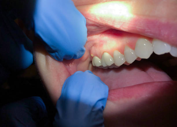 Best Cosmetic Emergency Dentistry in Fairborn, OH