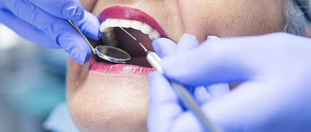 Best Emergency Gum Treatment in Fairborn, OH